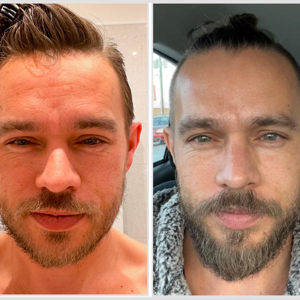 Before and after — Chris