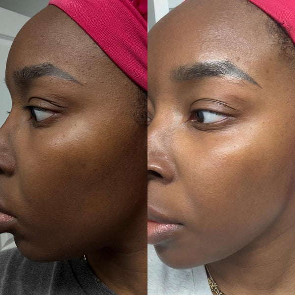 Before and after — Jessica